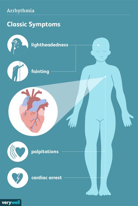 arrhythmia symptoms and signs